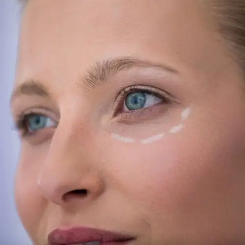 Behandlung der Tränenrinne bei Eye Refine Hamburg