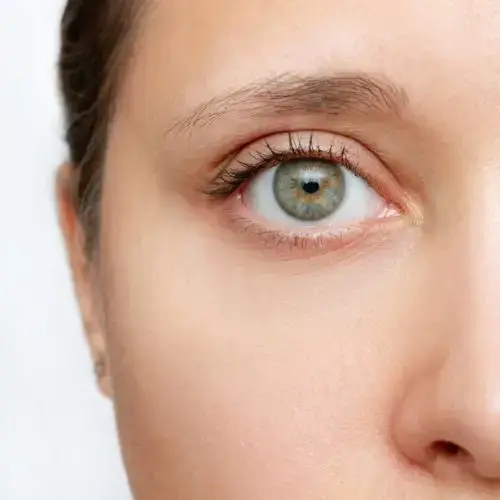 Behandlung von Augenringen bei Eye Refine Hamburg